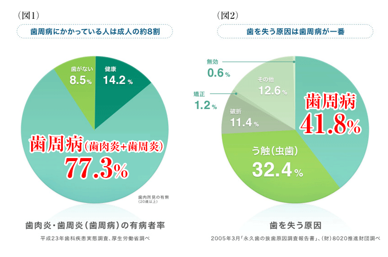 歯周病にかかっている人は成人の約8割