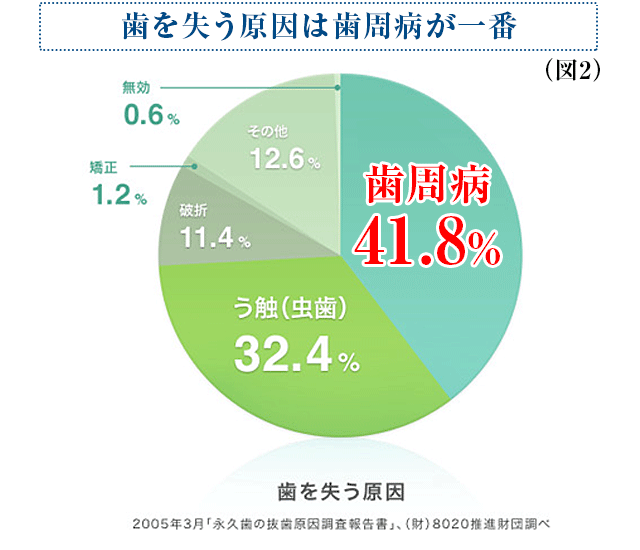 歯を失う原因は歯周病が一番