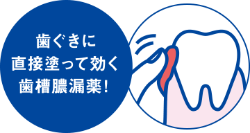 歯ぐきに直接塗って効く歯槽膿漏薬