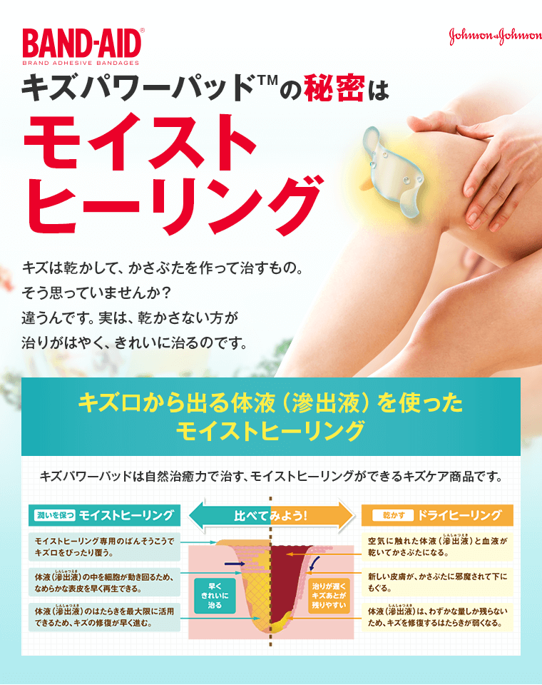 キズパワーパッドTMの秘密はモイストヒーリング
