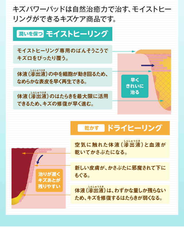 潤いを保つモイストヒーリング