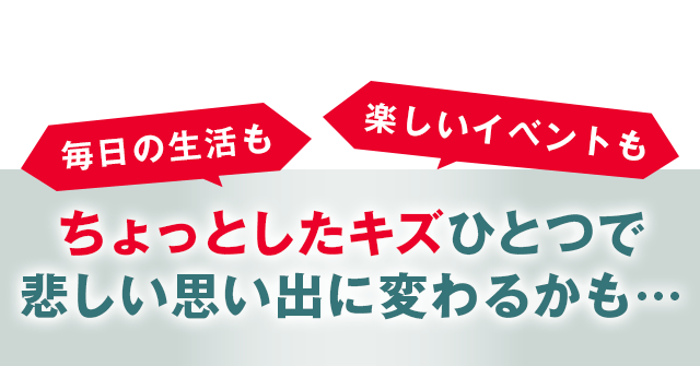 ちょっとしたキズひとつで悲しい思い出に変わるかも…