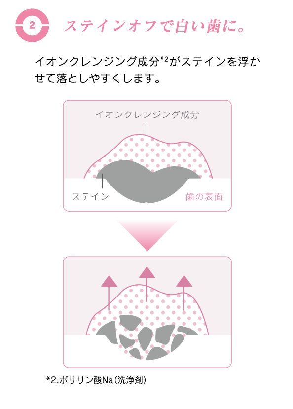 ステインオフで白い歯に。