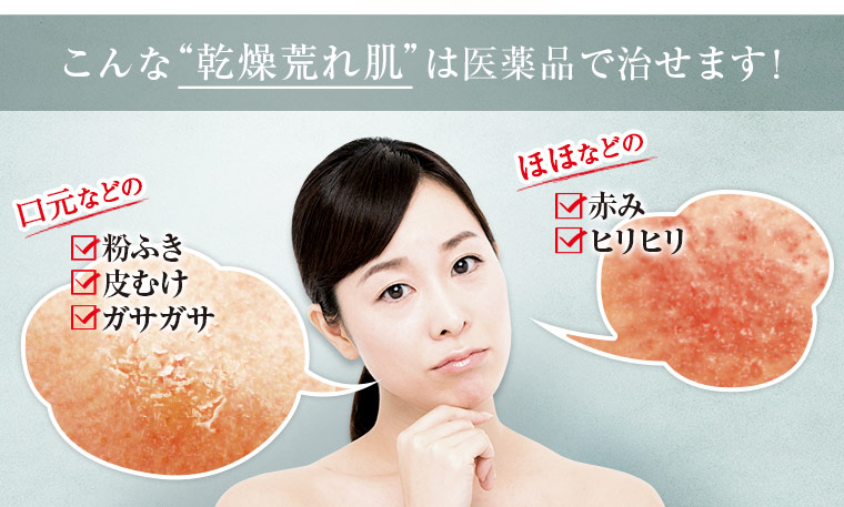 こんな乾燥荒れ肌は医薬品で治せます！