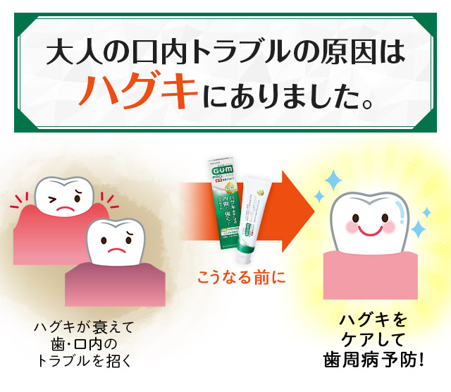 大人の口内トラブルの原因はハグキにありました。