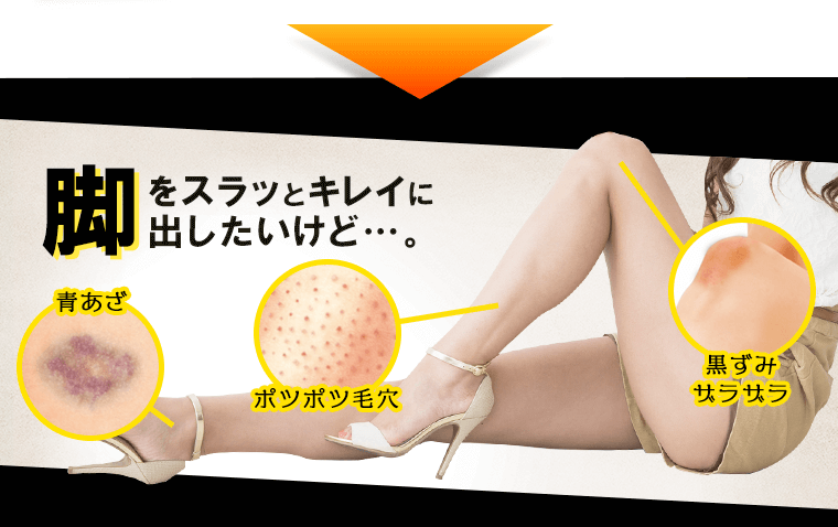 脚をスラッとキレイに出したいけど… 青あざ ポツポツ毛穴 黒ずみザラザラ