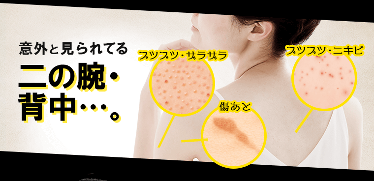 意外と見られてる二の腕・背中… ブツブツ・ザラザラ 傷あと ブツブツ・ニキビ