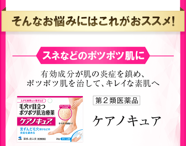 スネなどのポツポツ肌に 有効成分が肌の炎症を鎮め、ポツポツ肌を治して、キレイな素肌へ ケアノキュア