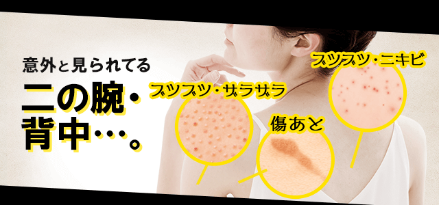 意外と見られてる二の腕・背中… ブツブツ・ザラザラ 傷あと ブツブツ・ニキビ