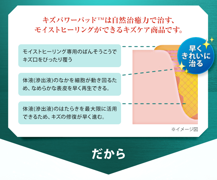 キズパワーパッドは自然治癒力で治す、モイストヒーリングができるキズケア商品です