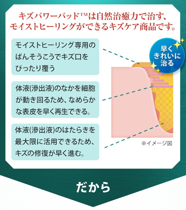 キズパワーパッドは自然治癒力で治す、モイストヒーリングができるキズケア商品です