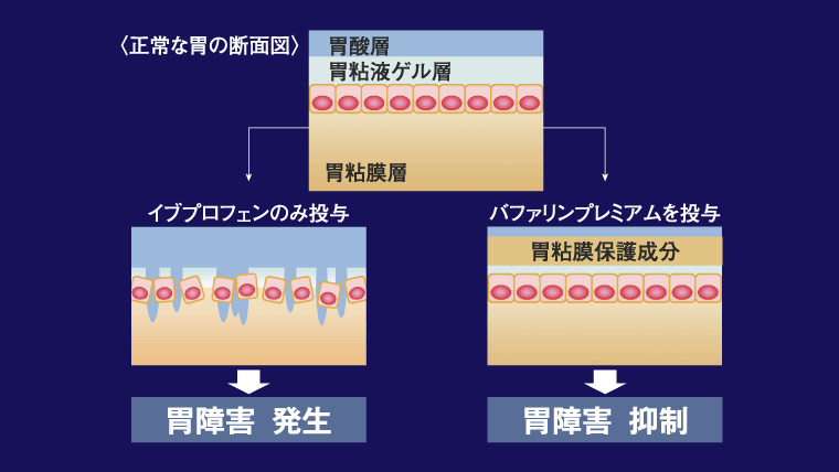 正常な胃の断面図