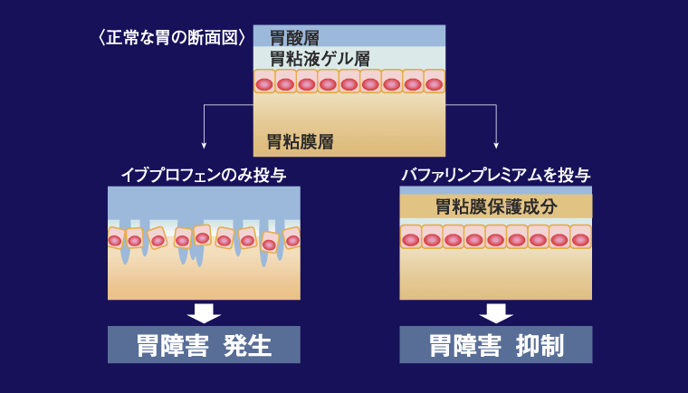 正常な胃の断面図