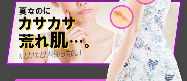 夏なのにカサカサ荒れ肌…