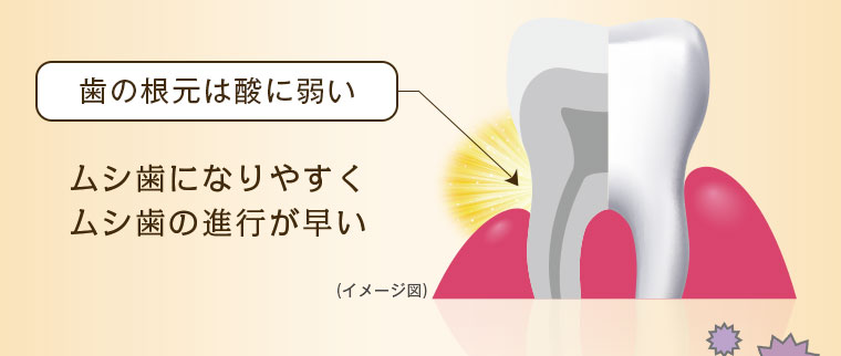 歯の根元は酸に弱い