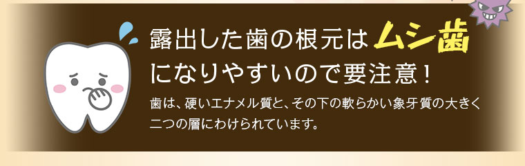 露出した歯の根元はムシ歯になりやすいので要注意
