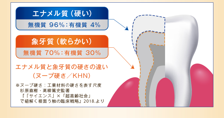 エナメル質（硬い）