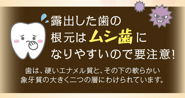 露出した歯の根元はムシ歯になりやすいので要注意