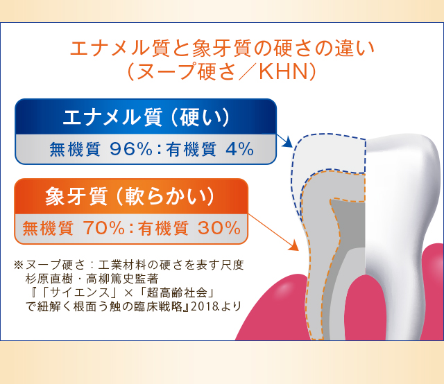 エナメル質（硬い）