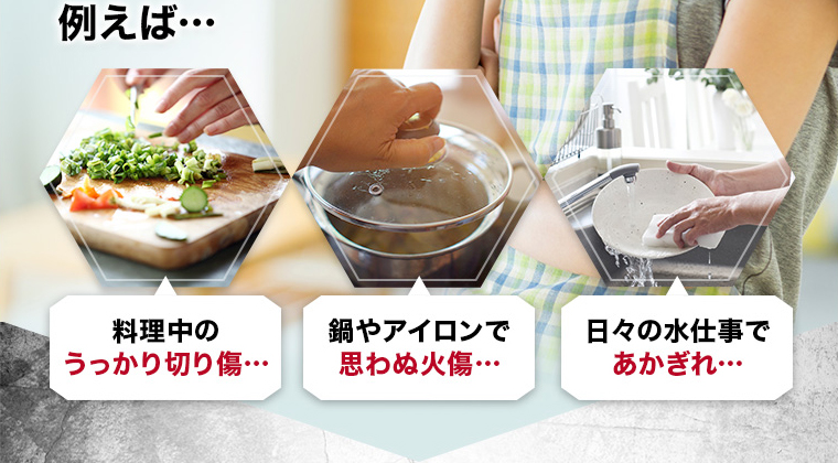 たとえば、料理中の うっかり切り傷… 鍋やアイロンで 思わぬ火傷… 日々の水仕事で あかぎれ…
