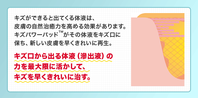 キズ口から出る体液（滲出液）の力を最大限に活かして、キズを早くきれいに治す。