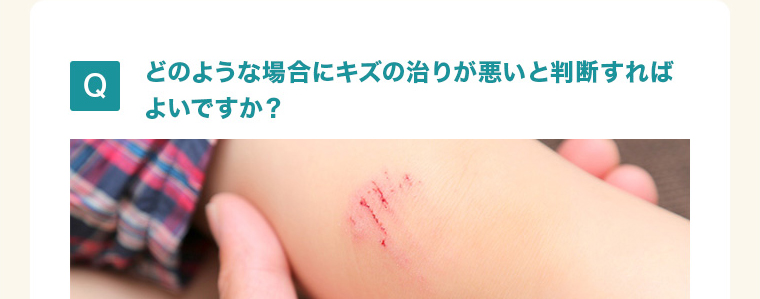 どのような場合にキズの治りが悪いと判断すれば よいですか？ 