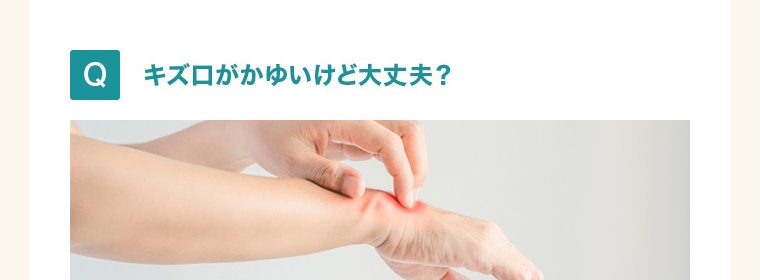 キズ口がかゆいけど大丈夫？