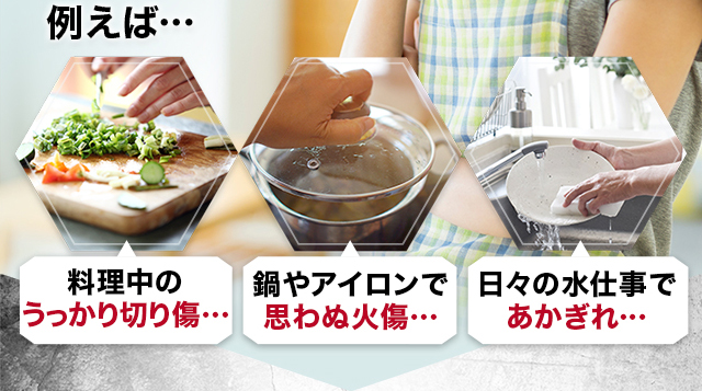 たとえば、料理中の うっかり切り傷… 鍋やアイロンで 思わぬ火傷… 日々の水仕事で あかぎれ…