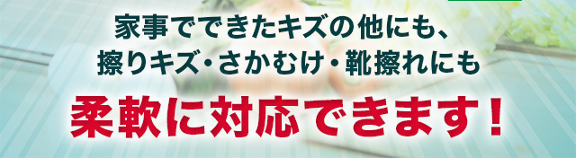 家事でできたキズの他にも、擦りキズ・さかむけ・靴擦れにも柔軟に対応できます！