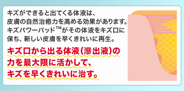 キズ口から出る体液（滲出液）の力を最大限に活かして、キズを早くきれいに治す。