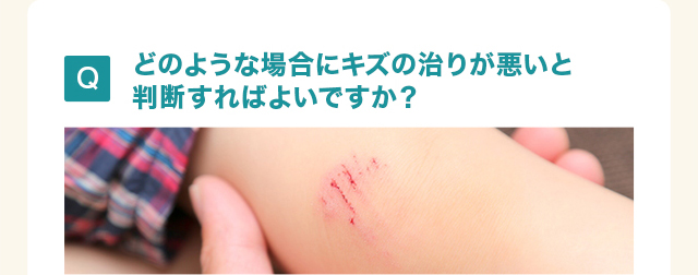 どのような場合にキズの治りが悪いと判断すれば よいですか？ 