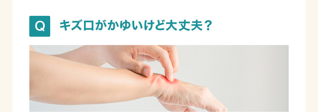 キズ口がかゆいけど大丈夫？