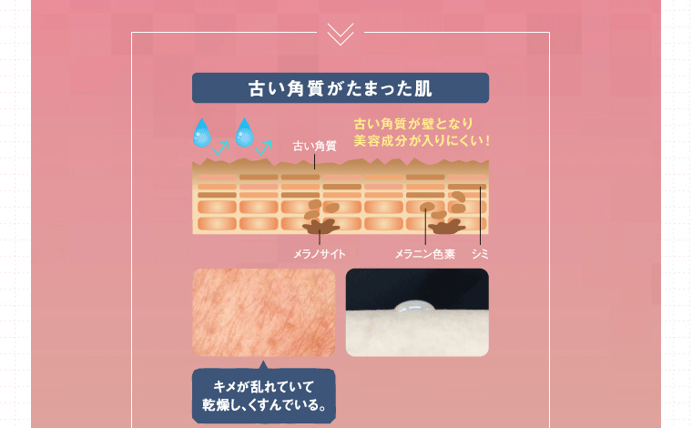 古い角質がたまった肌