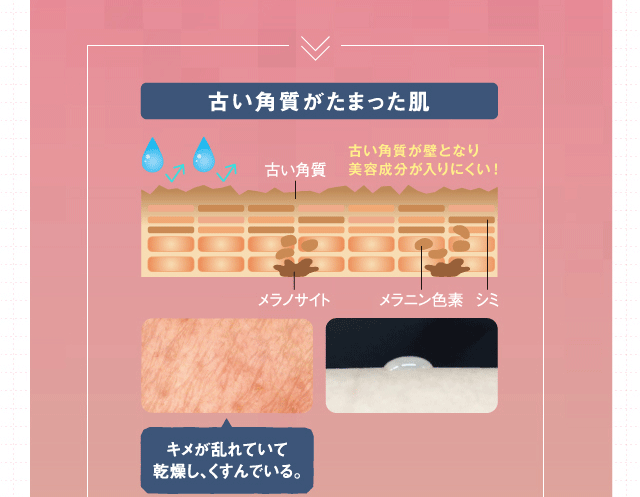 古い角質がたまった肌
