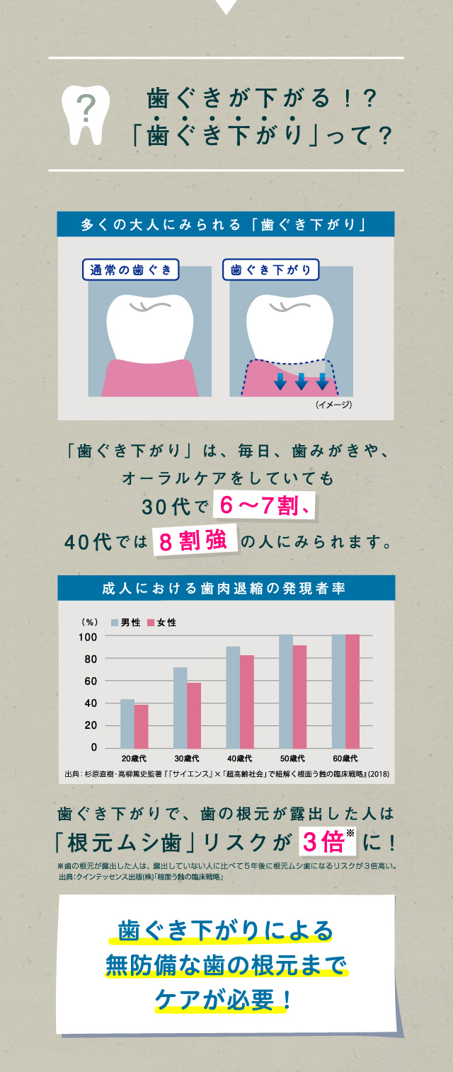 歯ぐきが下がる！？「歯ぐき下がり」って？