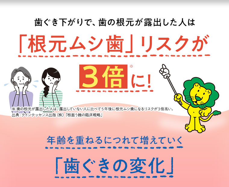 歯ぐき下がりで、歯の根元が露出した人は「根元ムシ歯」リスクが３倍に！