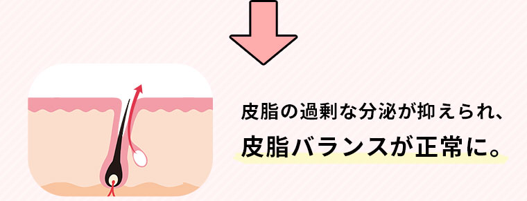 皮脂の過剰な分泌が抑えられ、皮脂バランスが正常に。
