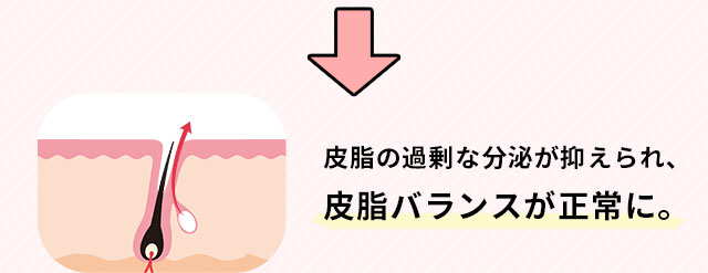 皮脂の過剰な分泌が抑えられ、皮脂バランスが正常に。