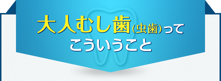 大人むし歯(虫歯)ってこういうこと