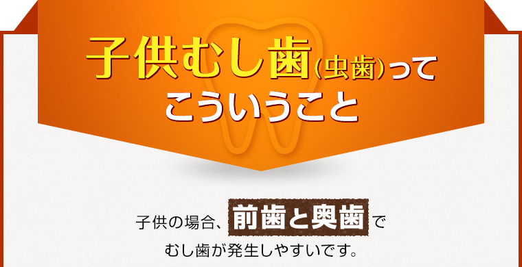 子供むし歯(虫歯)ってこういうこと