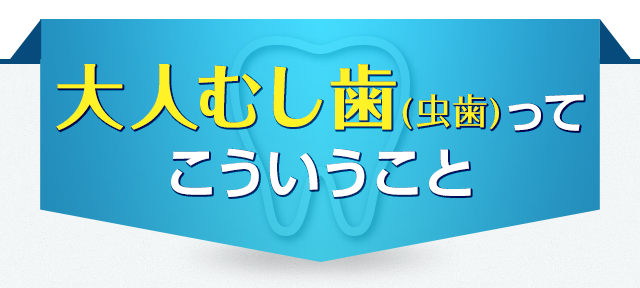 大人むし歯(虫歯)ってこういうこと