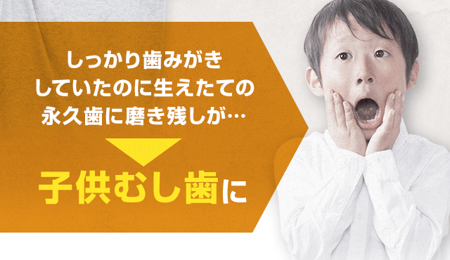 しっかり歯みがきしていたのに生えたての永久歯に磨き残しが