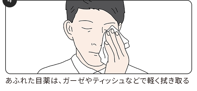 あふれた目薬は、ガーゼやティッシュなどで軽く拭き取る