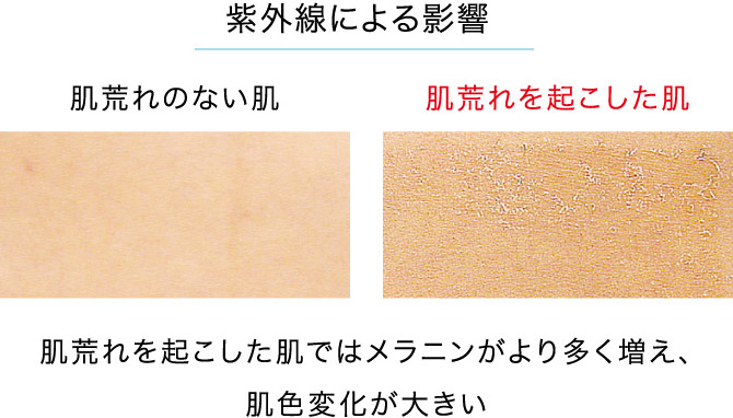 紫外線による影響