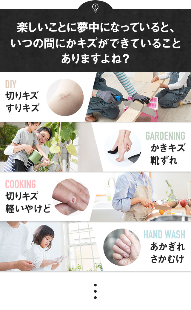 楽しいことに夢中になっていると、いつの間にかキズができていることありますよね？