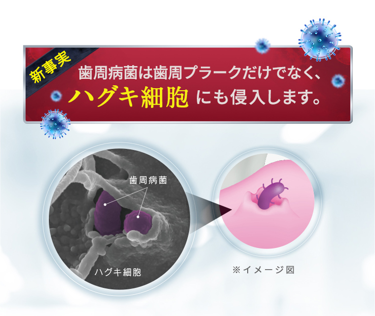 新事実 歯周病菌は歯周プラークだけでなく、ハグキ細胞にも侵入します。