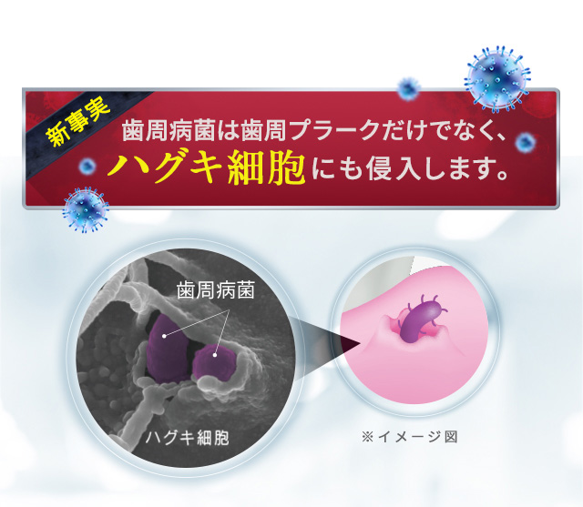 新事実 歯周病菌は歯周プラークだけでなく、ハグキ細胞にも侵入します。