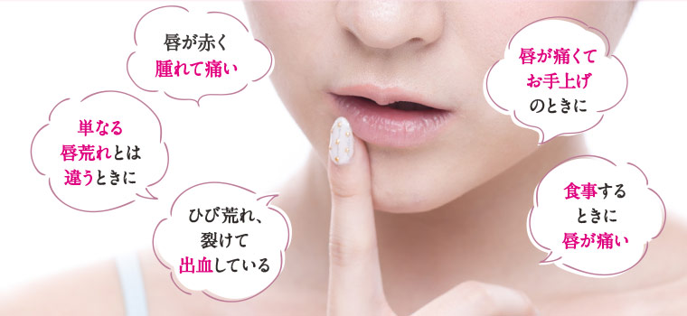 唇が赤く腫れて痛い　単なる唇荒れとは違うときに　ひび荒れ、裂けて出血している　唇が痛くてお手上げのときに　食事するときに唇が痛い