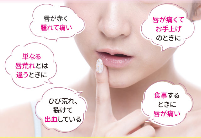 唇が赤く腫れて痛い　単なる唇荒れとは違うときに　ひび荒れ、裂けて出血している　唇が痛くてお手上げのときに　食事するときに唇が痛い