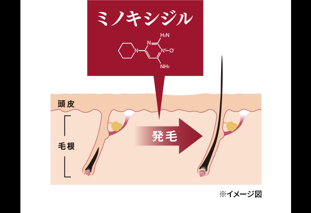発毛のイメージ図